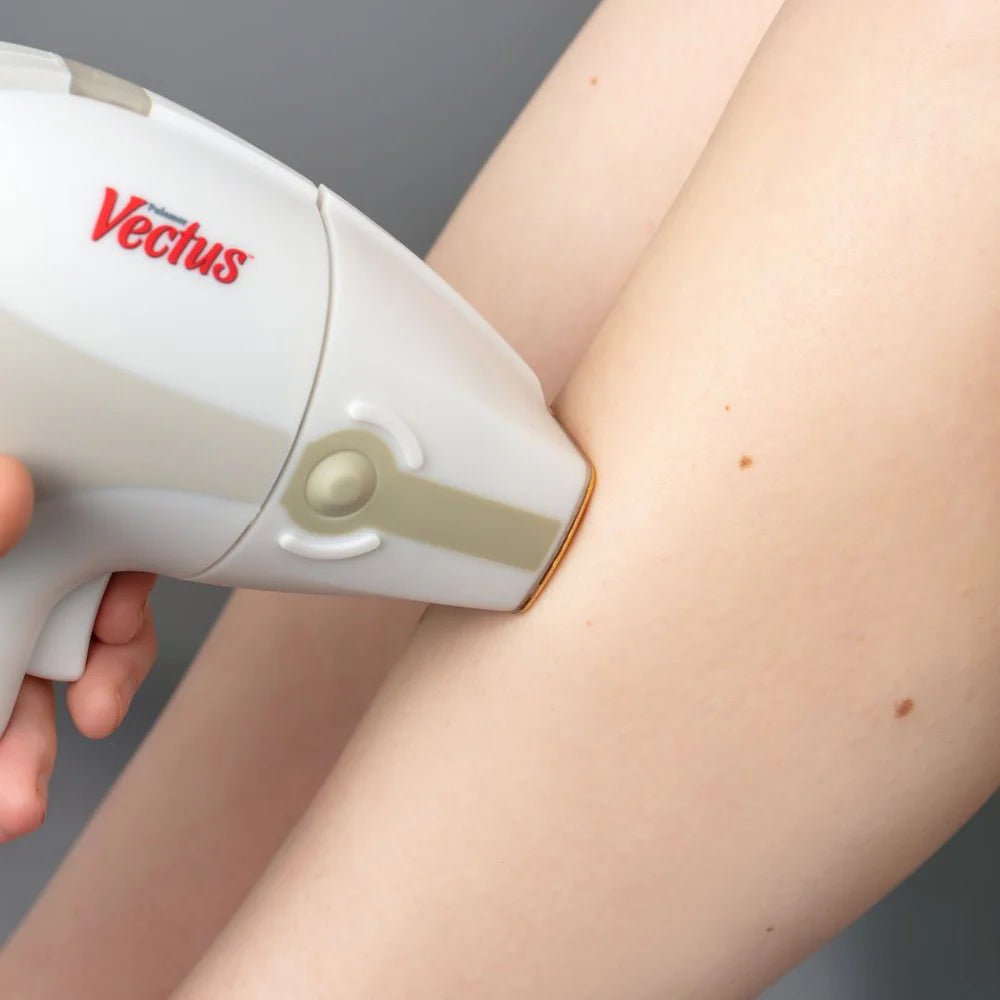 WAXON Vectus Laser Hair Removal machine being used on a client's legs.